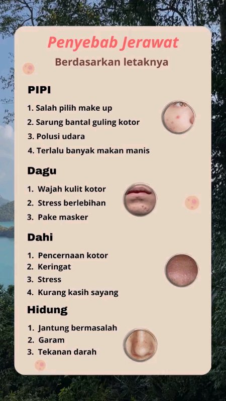 cara terbaik atasinya#RacunShopee