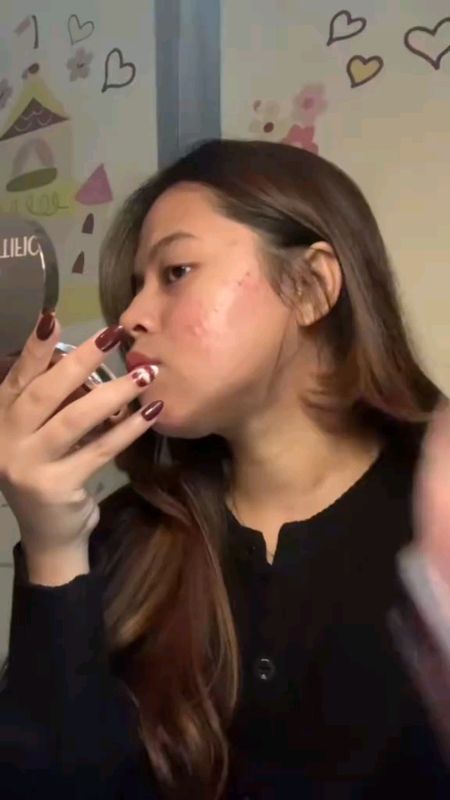 Dermatix acne spot care #dermatixacne #DermatixAcneSpotCare #dermatixacnespot #shopeevideo #ShopeeLook #ShopeeCOD #fypシ #fyp #fypdongggggggg #lewatber
