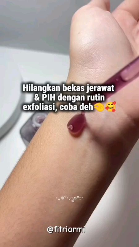 hilangkan bekas jerawat #SpillRacunShopee #RacunShopee #facetologytriplecareexfoliquid #facetologytriplecare #facetologyexfoliatin
