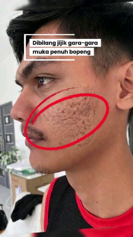 #drfayserumpenghilangbopengflekhitamdanjerawat#RacunShopeeCheck#DiskonRacunShopee