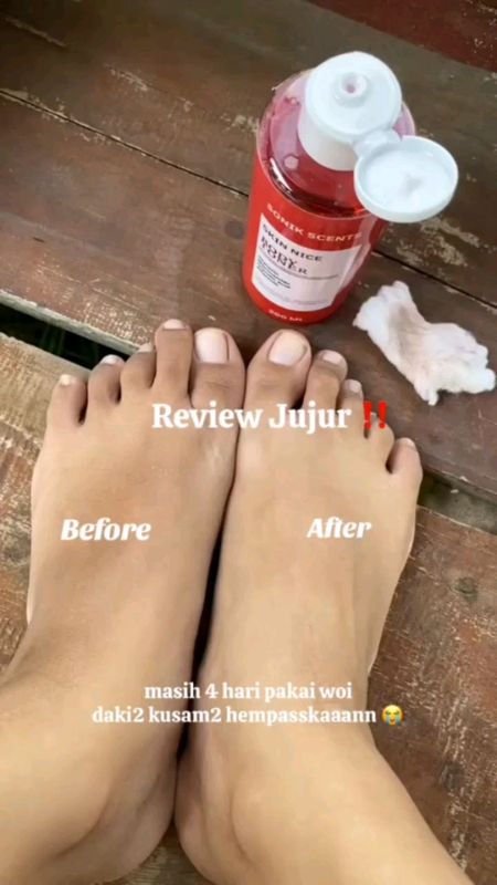 no pilter pilter yak, dah buru cobain sendiri #shopeevideo #ShopeeBeautyHaul #bodytoner #bodycare #promomurah
