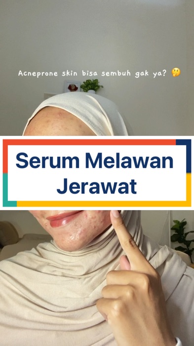 Serum Melawan Jerawat#RacunShopee#GratisOngkirRP0#ViralDiShopeeVideo#shopeevideo#fyp#viral#ShopeeLook#ShopeeCOD#RacunShopee#shopeevideo