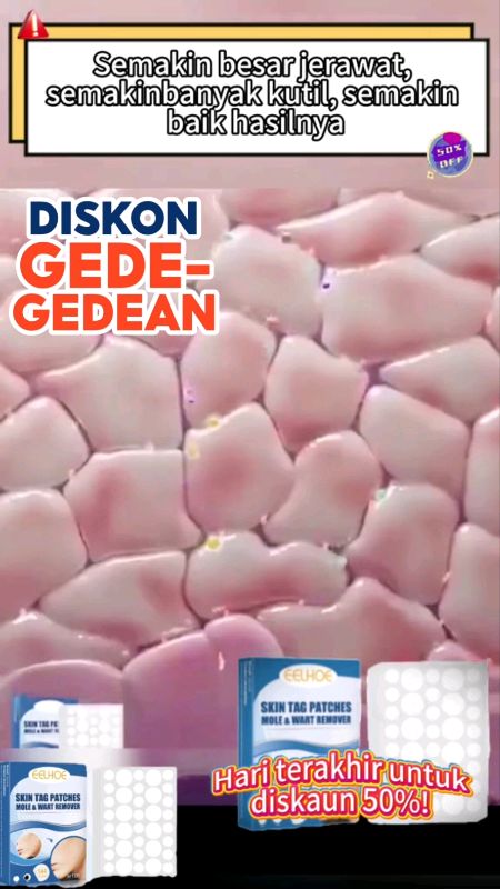 Stiker Penghilang Kutil dan Tahi Lalat ♥️#RacunShopee #RacunShopeeCheck #ShopeeVideoCreator #videoshopee #RacunShopeeUnik #ViralDiShopeeVideo #DiskonR
