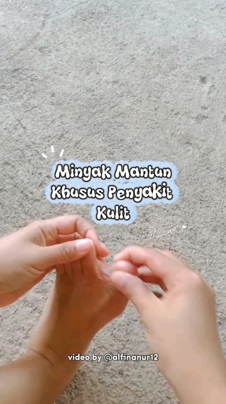 Jangan sampai kutu air bikin kamu korengan, atasi sekarang pakai minyak mantun ini. #minyakmantunmbahmijan #minyakmantunkulit #murahbanget #racunshope