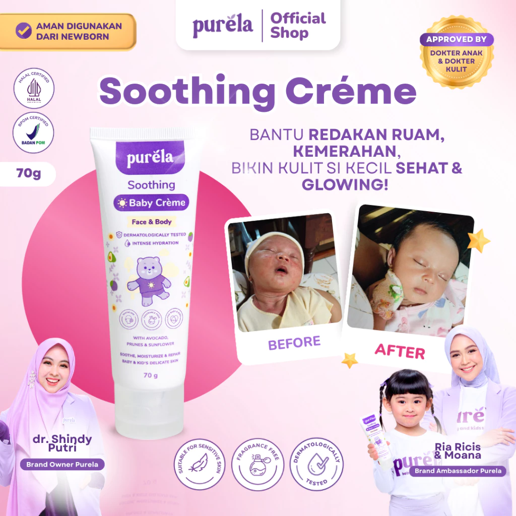 [PILIHAN RICIS DAN MOANA] PURELA Soothing Baby Creme 70 - Krim untuk Membantu Mengurangi Gatal karena Biang Keringat dan Ruam Popok - Bahan Alami dan Organik