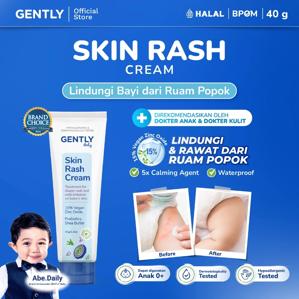 GENTLY  Baby Rash Cream 40 gr | Krim Pereda Ruam Popok pada Bayi