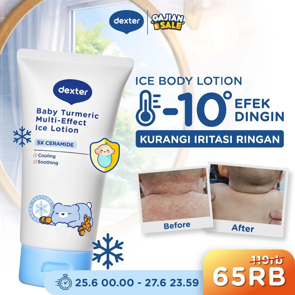[JUST RESTOCK] DEXTER Baby Turmeric Multi-Effect Ice Lotion | Solusi Kulit Bayi Kering | Body Lotion Bayi Anak dengan Efek Sensasi Dingin | 5X Ceramide & Panthenol & Jojoba Oil | Cocok untuk Kulit Kering, Sensitif, Ruam - Skincare Bayi Skincare Anak