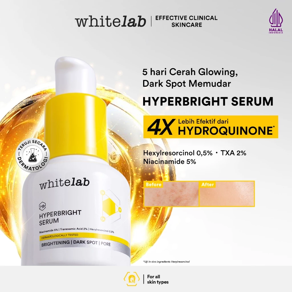 [NEW LAUNCH] Whitelab Hyperbright Brightening Serum - Serum Pencerah Wajah Lebih Efektif Dari Hydroquinon